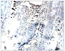 Anti-PGAP3 antibody (Internal) used in IHC (Paraffin sections) (IHC-P). GTX47870