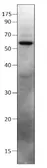 Anti-SHISA9 antibody used in Western Blot (WB). GTX47899