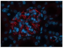 Anti-Bestrophin 3 antibody used in IHC (Paraffin sections) (IHC-P). GTX47910