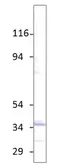 Anti-Aquaporin 6 antibody used in Western Blot (WB). GTX47918