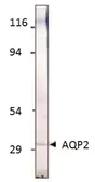 Anti-Aquaporin 2 antibody used in Western Blot (WB). GTX47923