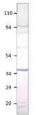 Anti-Aquaporin 12 antibody used in Western Blot (WB). GTX47925
