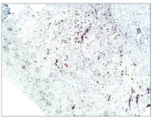 Anti-Aquaporin 1 antibody used in IHC (Paraffin sections) (IHC-P). GTX47931