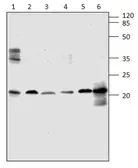 Anti-ARF4 antibody used in Western Blot (WB). GTX47932
