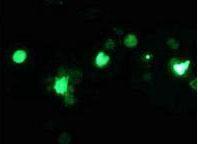 Anti-Renilla Luciferase antibody used in Immunocytochemistry/ Immunofluorescence (ICC/IF). GTX47953