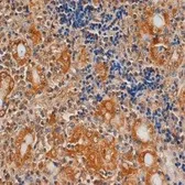 Anti-TSH receptor antibody [4C1] used in IHC (Paraffin sections) (IHC-P). GTX47974