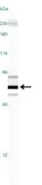 Anti-SSEA-1 / CD15 antibody [MC-480] used in Western Blot (WB). GTX48035