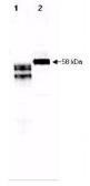 Anti-Fetuin A antibody used in Western Blot (WB). GTX48479