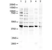 Anti-RNF2 antibody used in Western Blot (WB). GTX48486