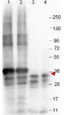 Anti-GDF15 antibody [23G10.F8] used in Western Blot (WB). GTX48497