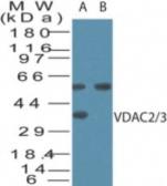 Anti-VDAC2/3 antibody used in Western Blot (WB). GTX48545