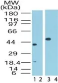 Anti-SIN1 antibody used in Western Blot (WB). GTX48547