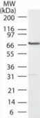 Anti-PLK1 antibody used in Western Blot (WB). GTX48549