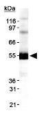Anti-DGAT1 antibody used in Western Blot (WB). GTX48577