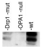 Anti-OPA1 antibody used in Western Blot (WB). GTX48589