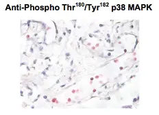 Anti-p38 MAPK (phospho Thr180/Tyr182) antibody used in Immunohistochemistry (IHC). GTX48614