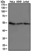 Anti-beta Tubulin antibody used in Western Blot (WB). GTX48617