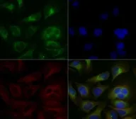 Anti-Grp78 antibody used in Immunocytochemistry/ Immunofluorescence (ICC/IF). GTX48633