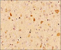 Anti-LC3A antibody used in IHC (Paraffin sections) (IHC-P). GTX48634