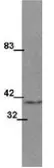 Anti-Wnt1 antibody [13F9] used in Western Blot (WB). GTX48642