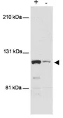 Anti-MTBP antibody [PHL-1] used in Western Blot (WB). GTX48646