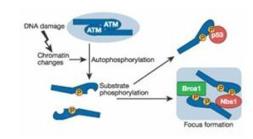 Anti-ATM (phospho Ser1981) antibody used in  (). GTX48650