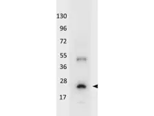 Anti-IL32A antibody (HRP) used in Western Blot (WB). GTX48654