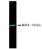 Anti-SLIT3 antibody used in  (). GTX48660