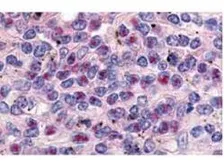 Anti-Cyclin L1 (Isoform 1) antibody used in IHC (Paraffin sections) (IHC-P). GTX48663