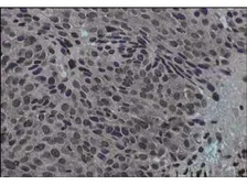 Anti-Jagged 1 antibody used in IHC (Paraffin sections) (IHC-P). GTX48691