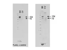Anti-ABCB6 antibody used in Western Blot (WB). GTX48698