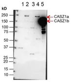 Anti-Casz1 antibody used in Western Blot (WB). GTX48704