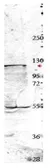 Anti-NEDD4 antibody used in Western Blot (WB). GTX48706