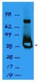 Anti-Lac I antibody used in Western Blot (WB). GTX48707