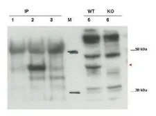 Anti-PSCDBP antibody used in Western Blot (WB). GTX48718