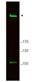 Anti-RIF1 antibody used in Western Blot (WB). GTX48737