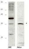 Anti-HUS1B antibody used in Western Blot (WB). GTX48745