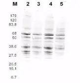Anti-Rfa2 (Pan Reactive) antibody used in Western Blot (WB). GTX48746
