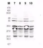 Anti-Rfa2 (phospho Ser122) antibody used in Western Blot (WB). GTX48747