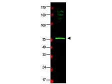 Anti-RAD23B antibody used in Western Blot (WB). GTX48751