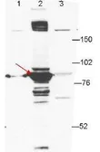 Anti-ESRP1 antibody [27H12] used in Western Blot (WB). GTX48761