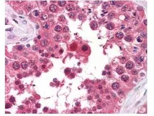 Anti-AHA-1 antibody [25F2.D9] used in IHC (Paraffin sections) (IHC-P). GTX48775