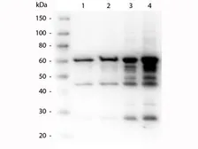 Anti-Borrelia burgdorferi p35 antibody used in Western Blot (WB). GTX48805