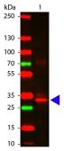 Anti-L-Asparaginase antibody used in Western Blot (WB). GTX48847