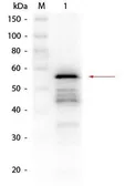 Anti-Aldehyde Dehydrogenase antibody used in Western Blot (WB). GTX48856