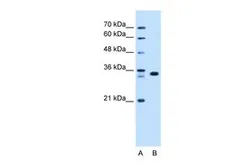 Anti-ARGFX antibody, N-term used in Western Blot (WB). GTX48894