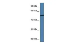 Anti-Adiponectin Receptor 2 antibody, N-term used in Western Blot (WB). GTX48936