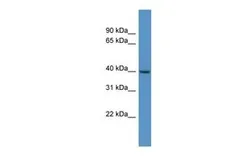 Anti-FOXS1 antibody, N-term used in Western Blot (WB). GTX48944