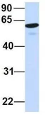 Anti-HIC2 antibody, Internal used in Western Blot (WB). GTX48945