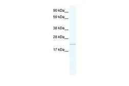 Anti-GTL3 antibody, C-term used in Western Blot (WB). GTX48956